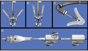 Figure 1: The MitraClip System