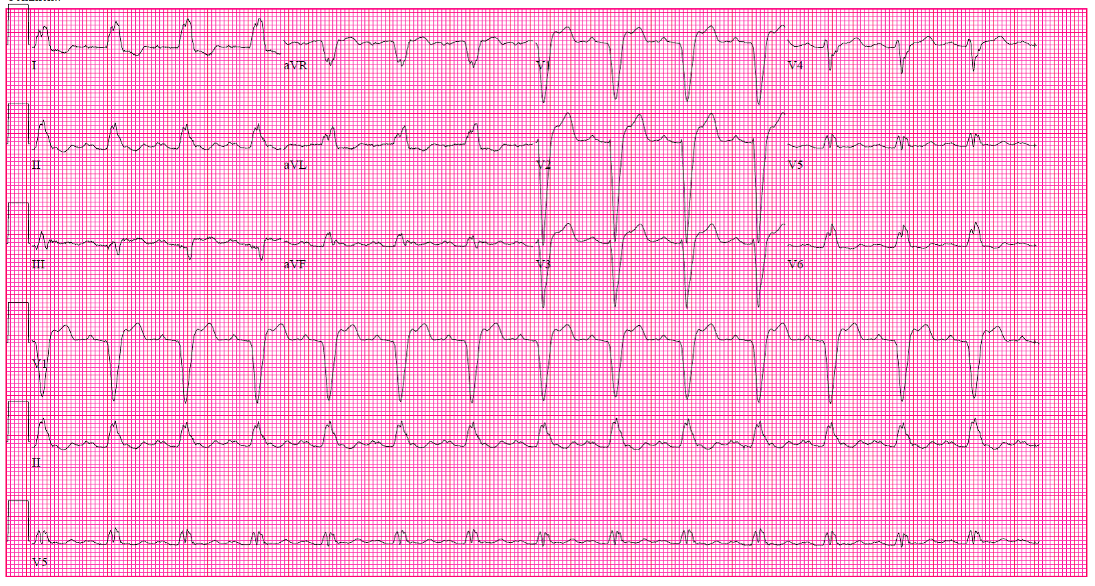 ECG Drill and Practice: Clinical Electrocardiography Review and Self