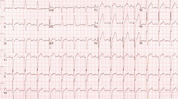 Geriatric Cardiology - American College of Cardiology