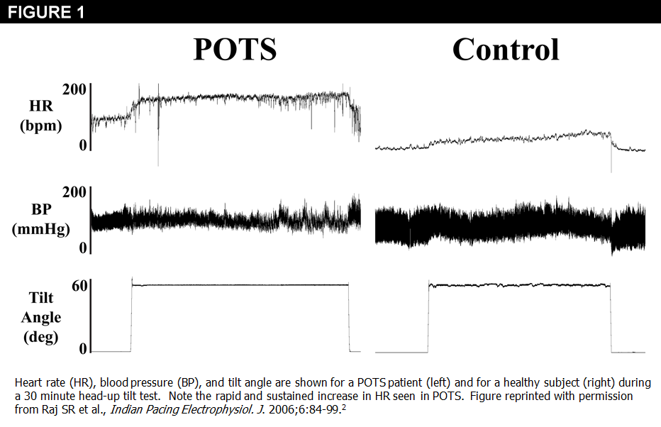 Diagnosis and management of postural orthostatic tachycardia syndrome