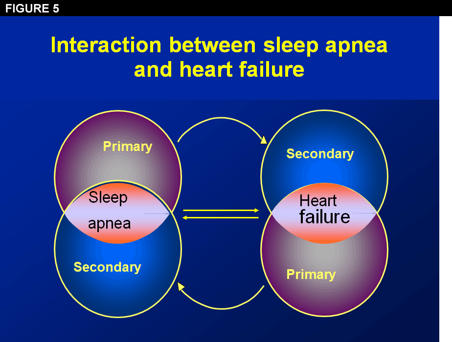 Basics Of Sleep Apnea And Heart Failure - American College Of Cardiology