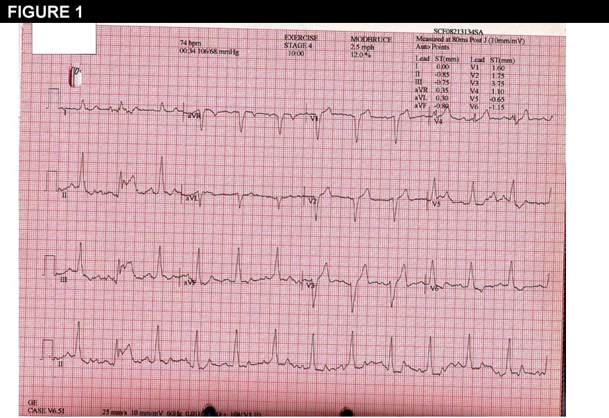 Figure 1: An 82-Year-Old Man With Worsening Exercise Tolerance