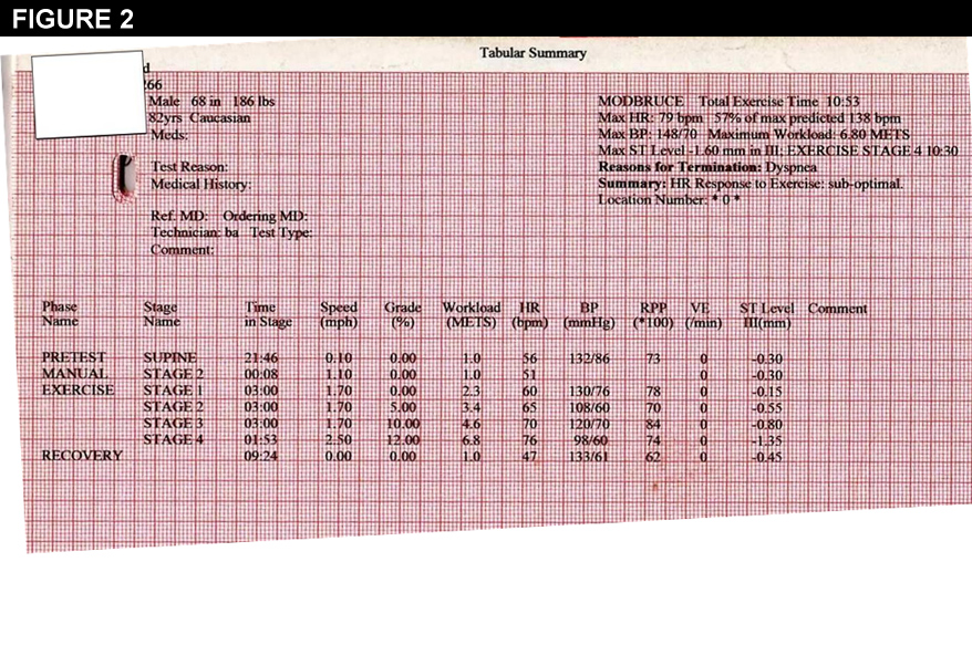 Figure 2: An 82-Year-Old Man With Worsening Exercise Tolerance