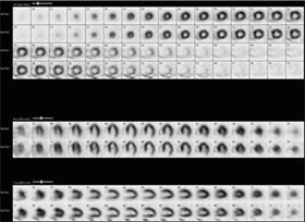 Figure 1: Perfusion images