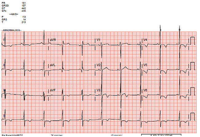 A 17-Year-Old Male Athlete Loses Consciousness and Becomes Apneic While Playing Basketball